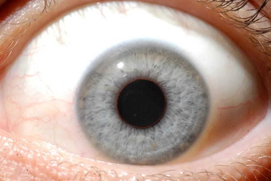 Analyse iridologique de l'iris
